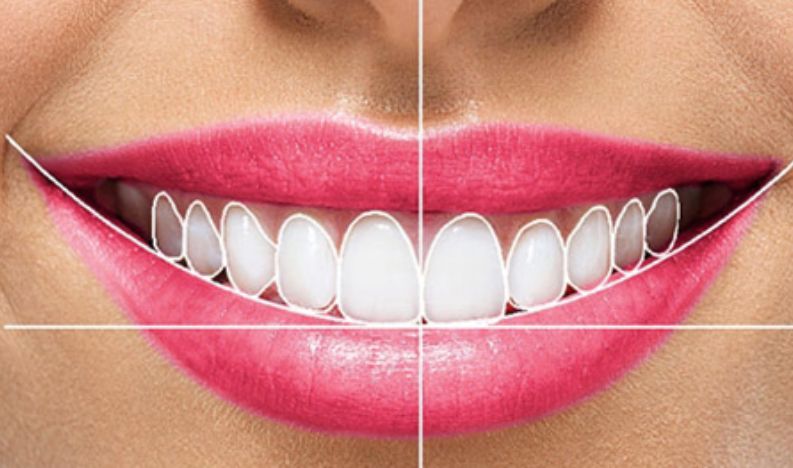 Untitled design (62)